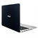 Asus K501LB DM077D- Vỏ nhôm